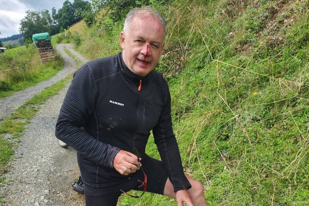 Foto: Andrej Kiska mal nehodu, mohla sa končiť tragicky. Život mu zachránila prilba, skončil celý krvavý